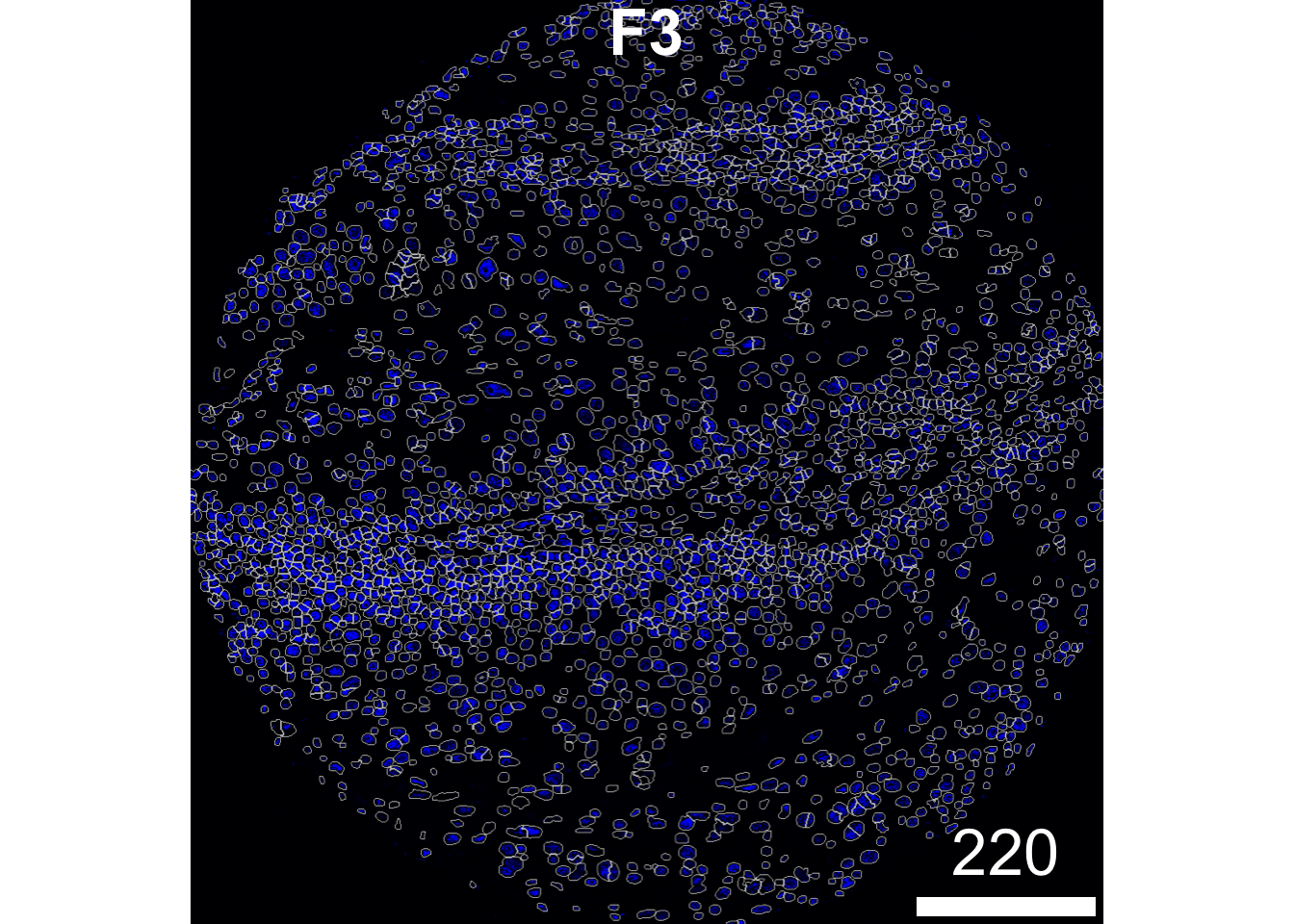 4 Cell segmentation and pre-processing – Spatial analysis playbook
