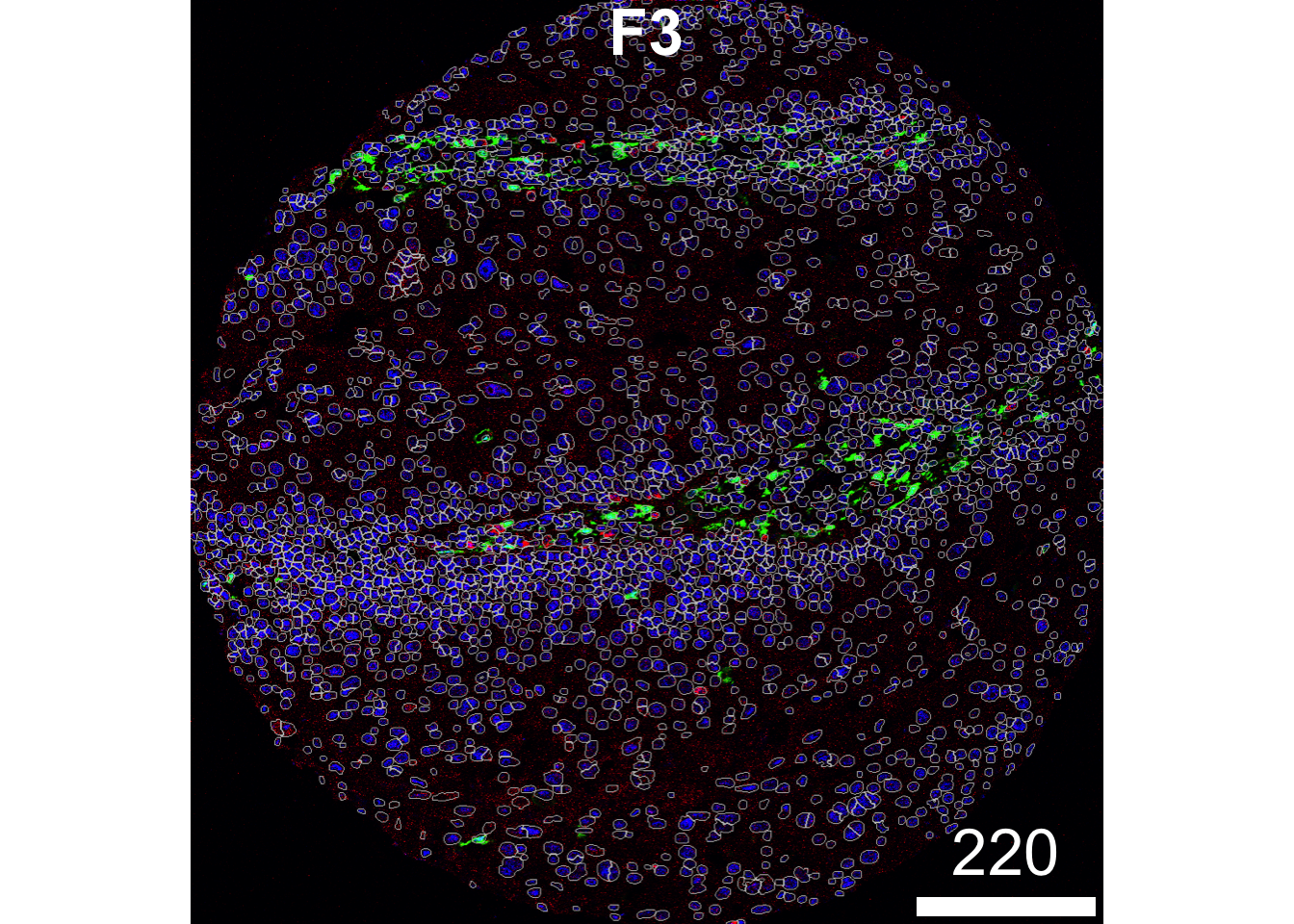 Cell Segmentation Spatial 4 Cell segmentation and pre-processing – Spatial analysis playbook